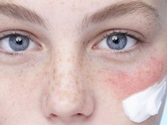 Как утолщить кожу на лице и под глазами: правильный уход и укрепление