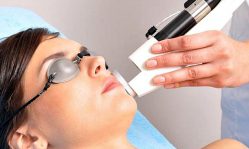 Лазерная чистка лица: процедура эффективного очищения кожи
