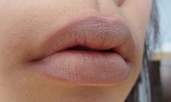 Как поднять опущенные уголки губ: домашние и косметологические средства
