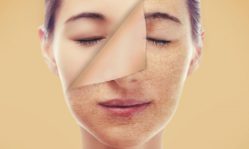 Чем можно улучшить кожу лица: активные компоненты